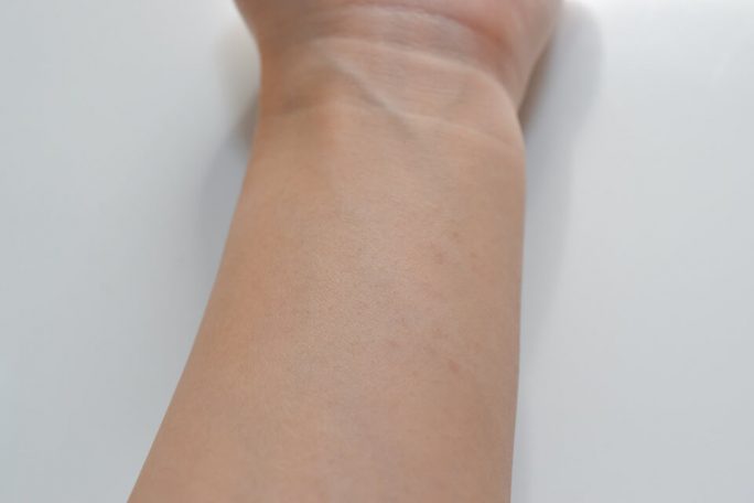 ミュゼコスメ薬用ヘアリムーバルクリームのパッチテスト後の肌
